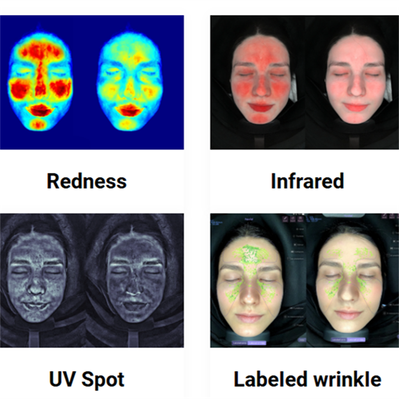 The Rise of AI-Powered Skin Analyzer Machines