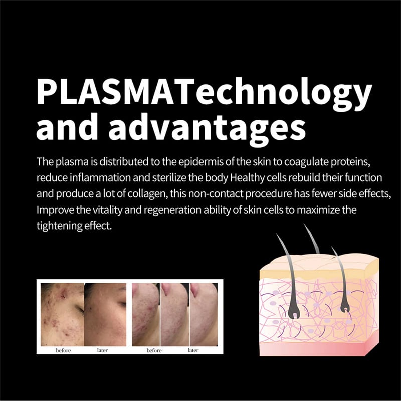 What Is Cold Plasma for Skin? Benefits & Applications