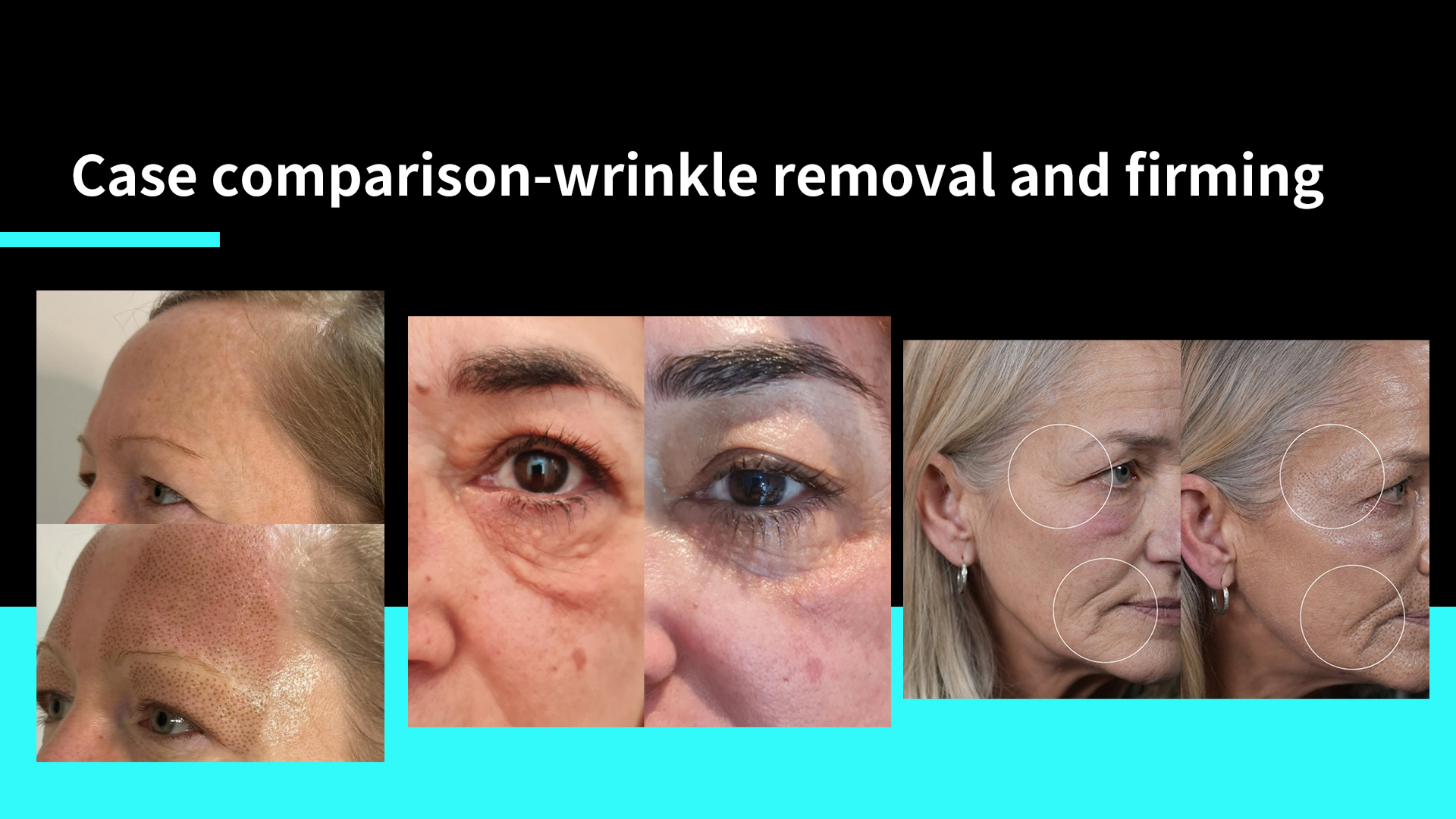 SKin Care Plasma-Shanghai Weijiayu Trading Co.,Ltd.