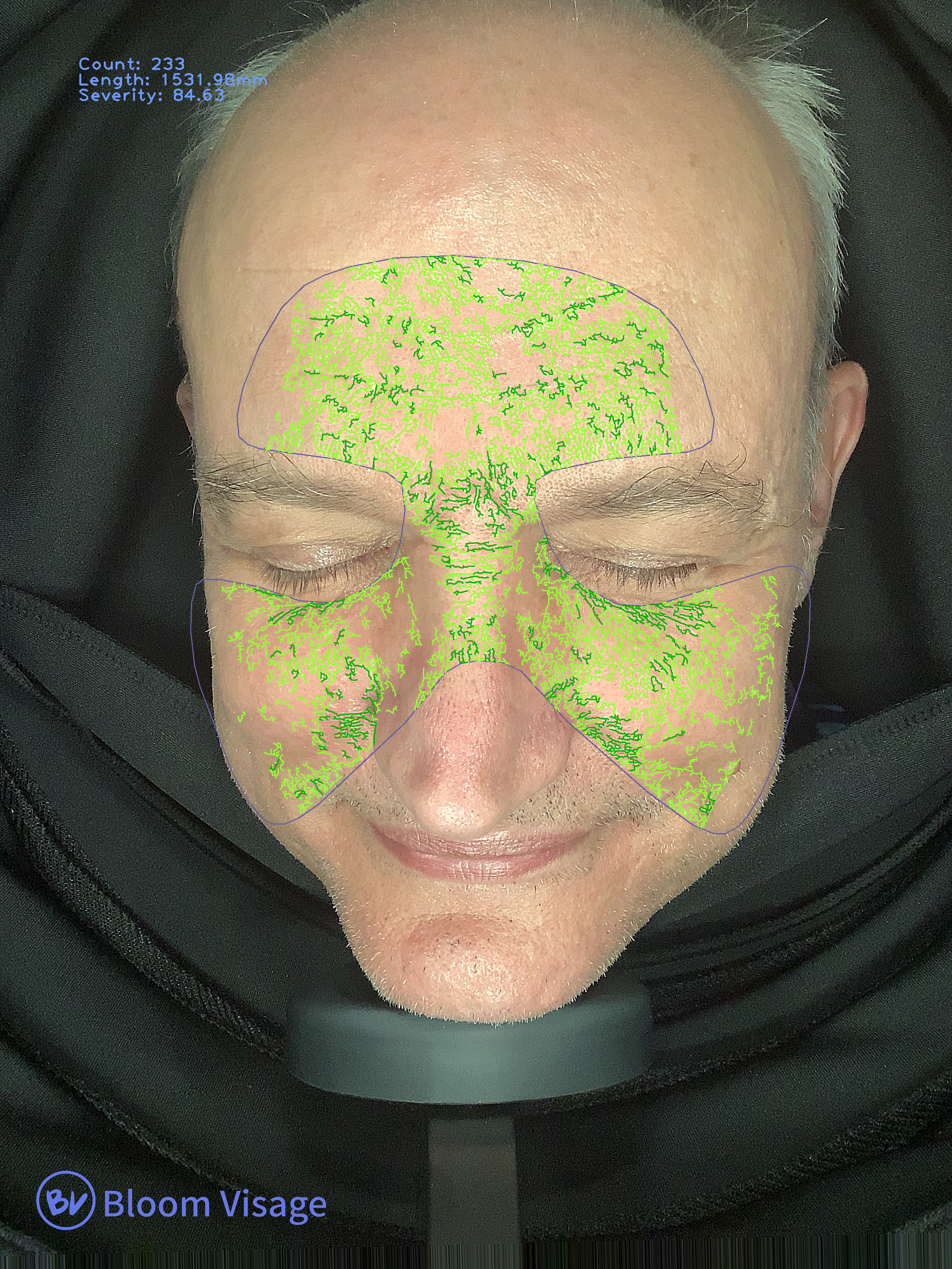 Labeled wrinkle