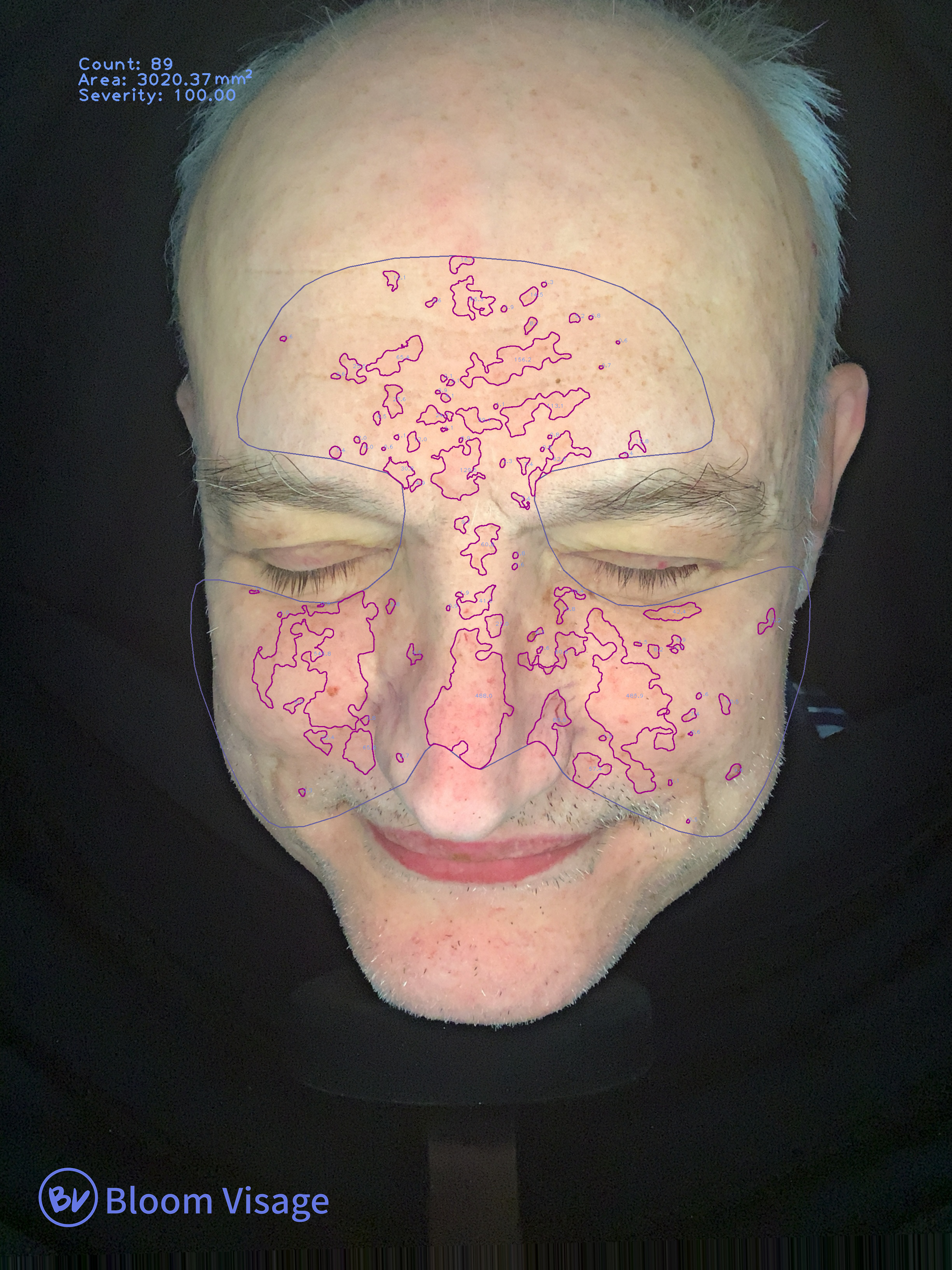 Labeled redness