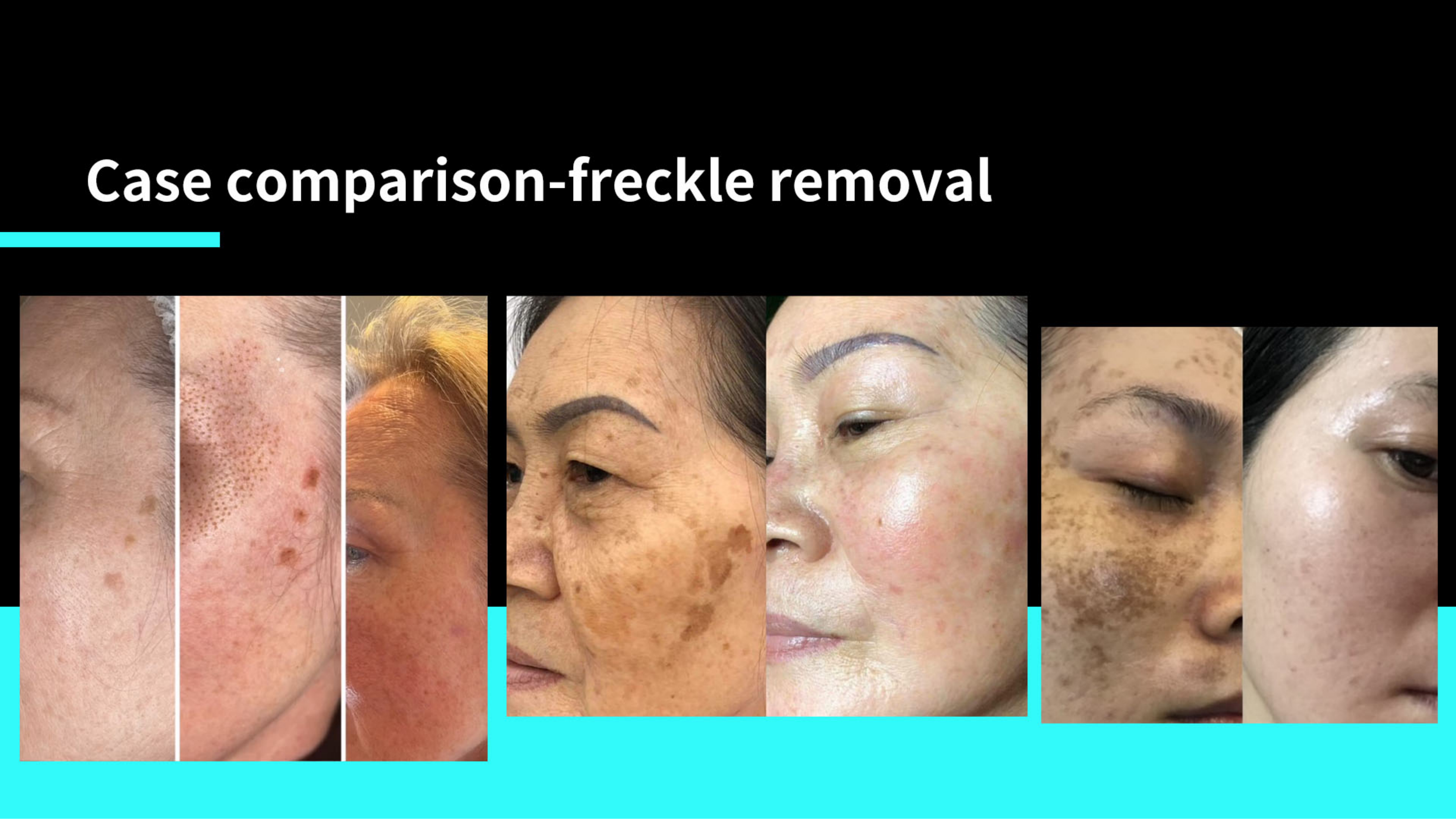 SKin Care Plasma-Shanghai Weijiayu Trading Co.,Ltd.