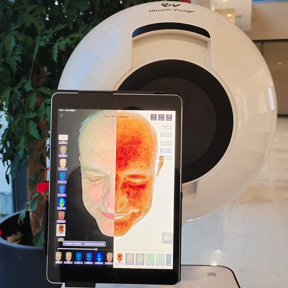 Affordable Medical-Grade Skin Detector for Small Beauty Clinics