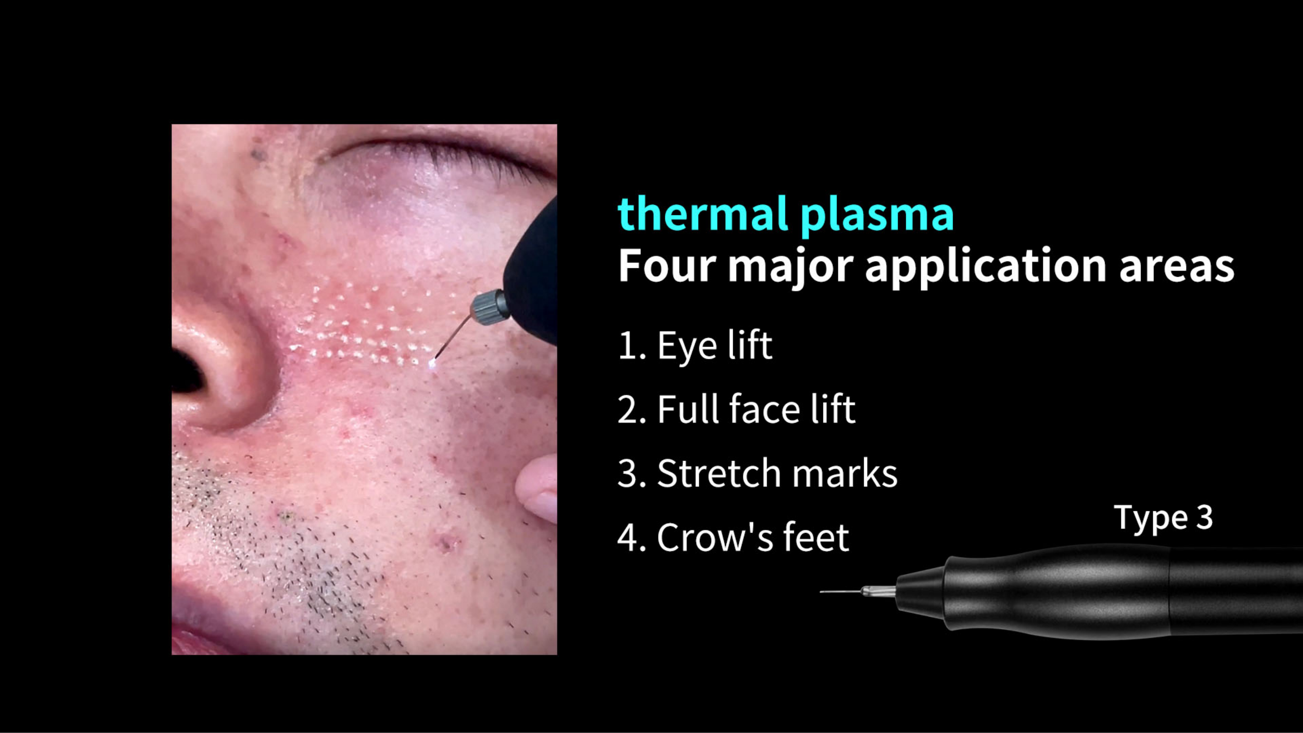 SKin Care Plasma-Shanghai Weijiayu Trading Co.,Ltd.
