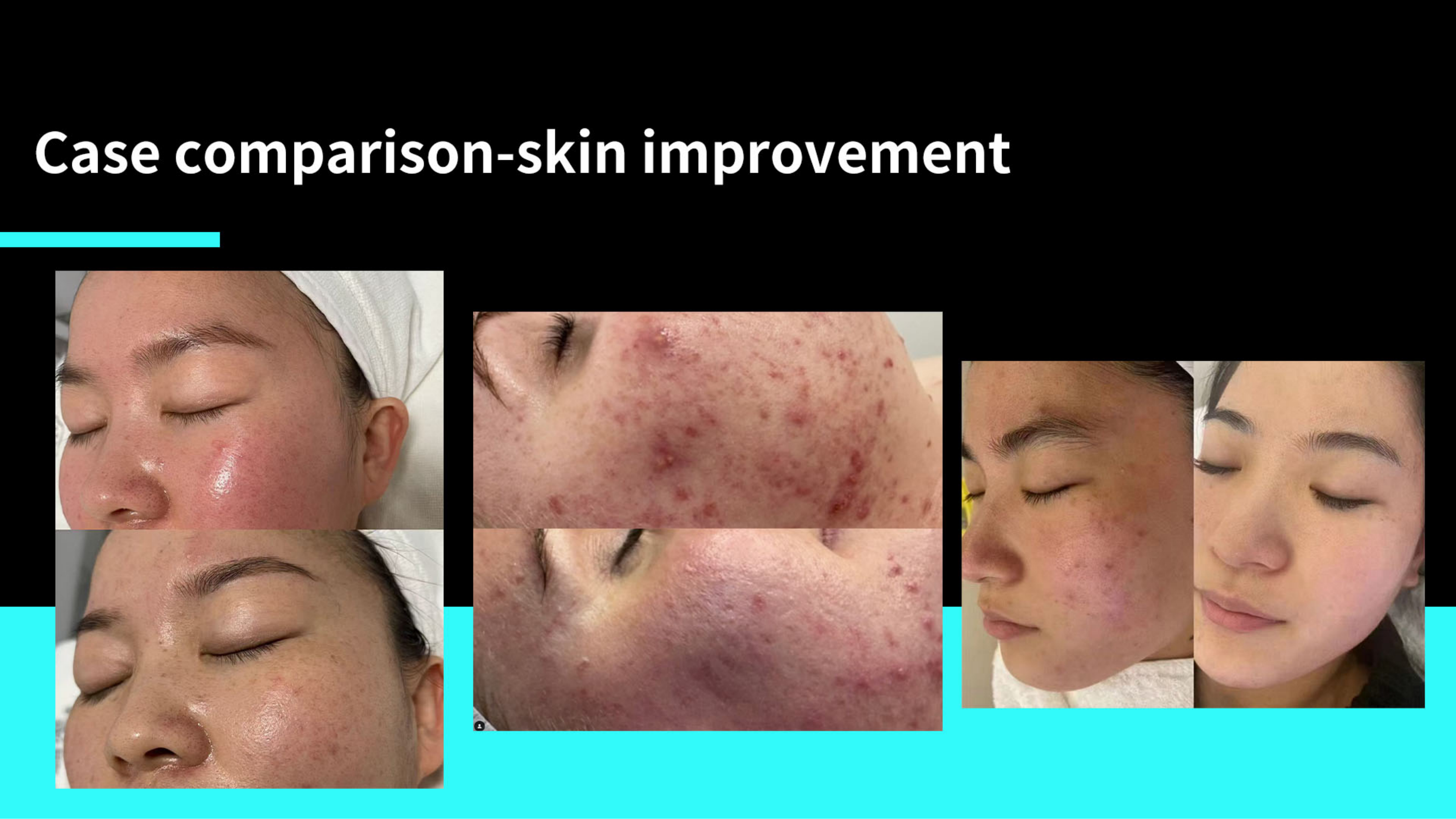 SKin Care Plasma-Shanghai Weijiayu Trading Co.,Ltd.