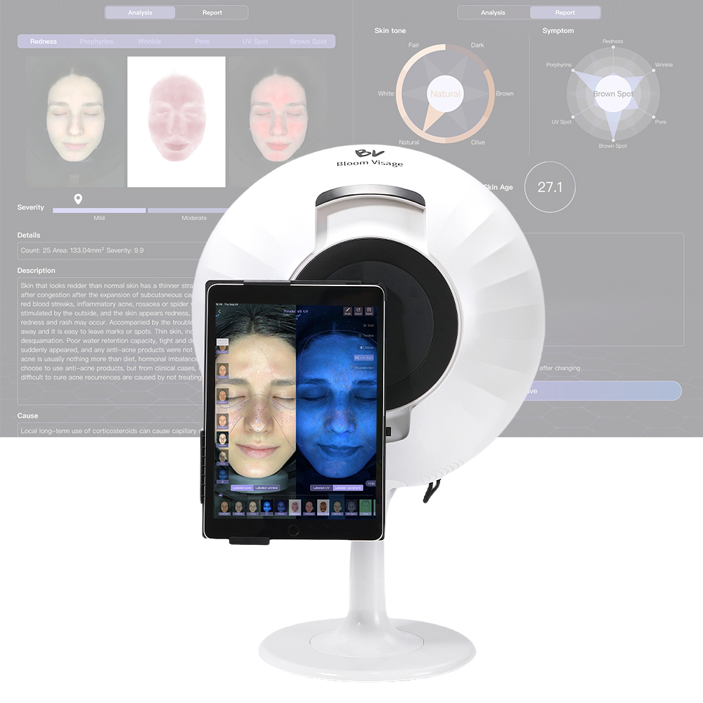 Russian Beauty Chain Brands Equip Stores with BV Professional Skin Analyzers