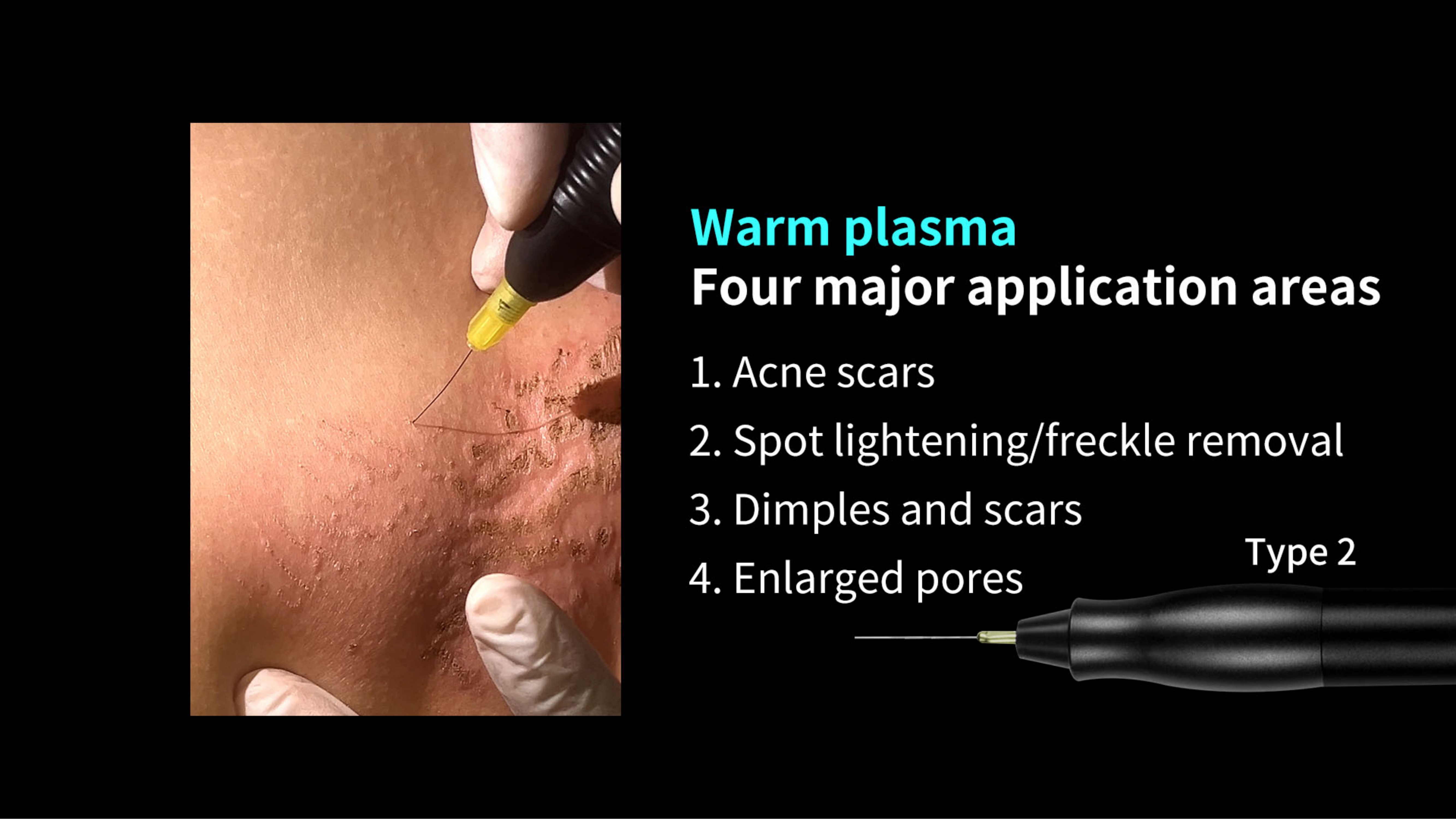SKin Care Plasma-Shanghai Weijiayu Trading Co.,Ltd.
