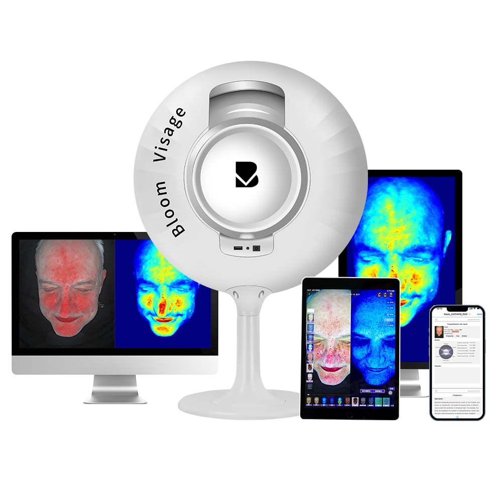 Cost-Saving Skin Diagnostic Equipment for Chain Beauty Stores