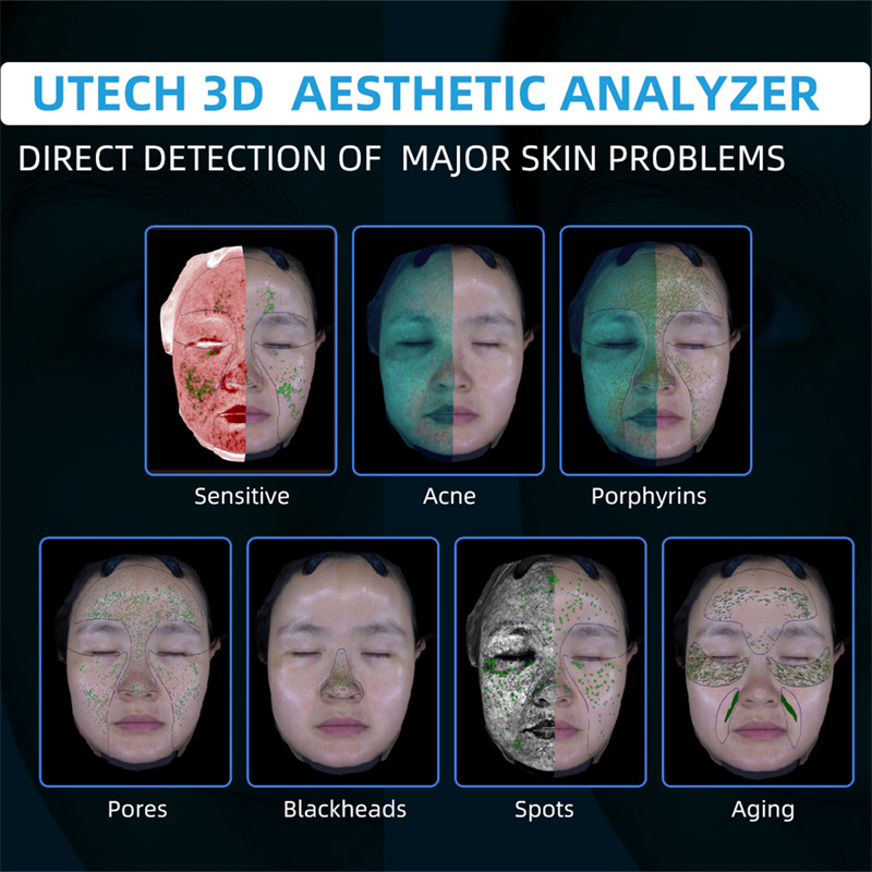 Why OEM Skin Analyzer Devices Are in High Demand