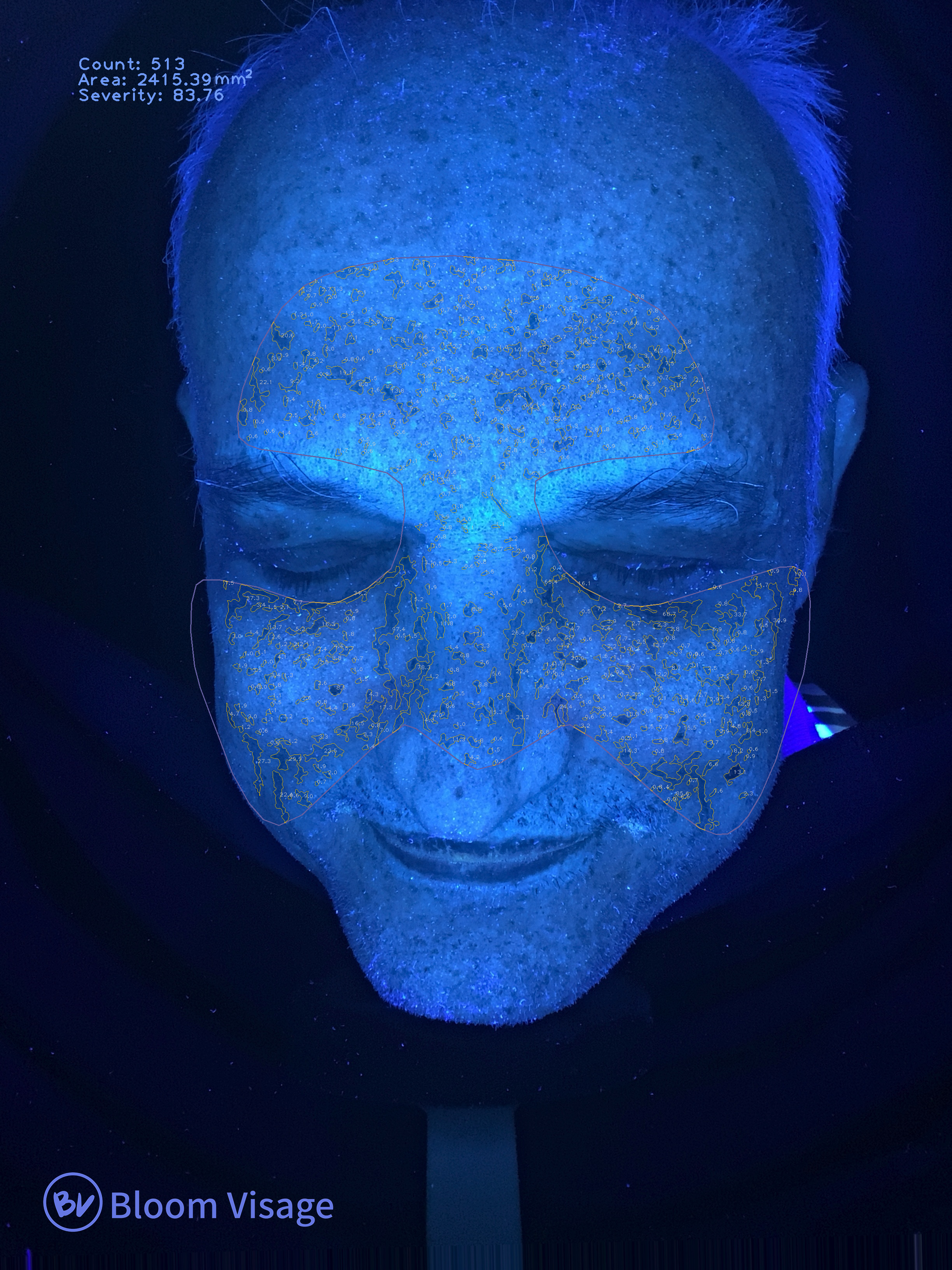 Labeled UV