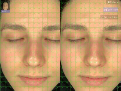 Integrating Cold Plasma Therapy into Your Beauty Clinic's Services