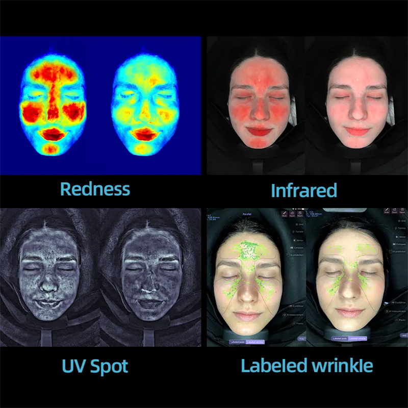 What’s Driving Demand for Digital Skin Analyzers