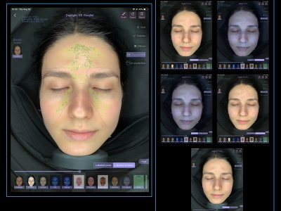 What Is Cold Plasma Therapy and How Does It Benefit Your Skin