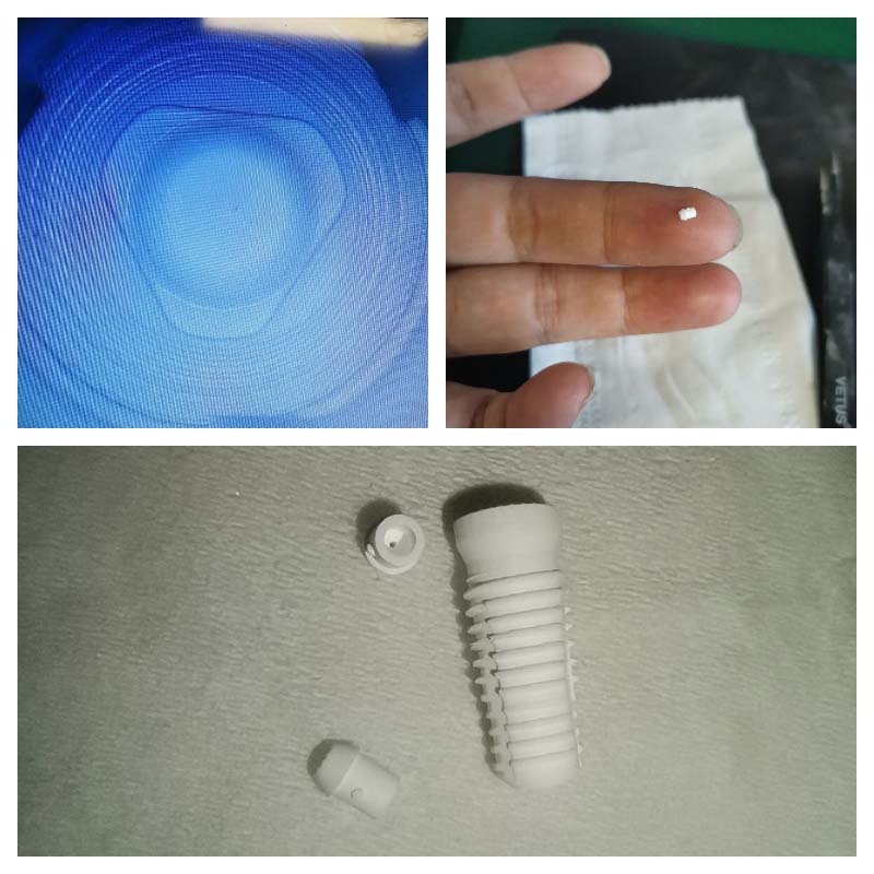 3D printing in ceramic ar