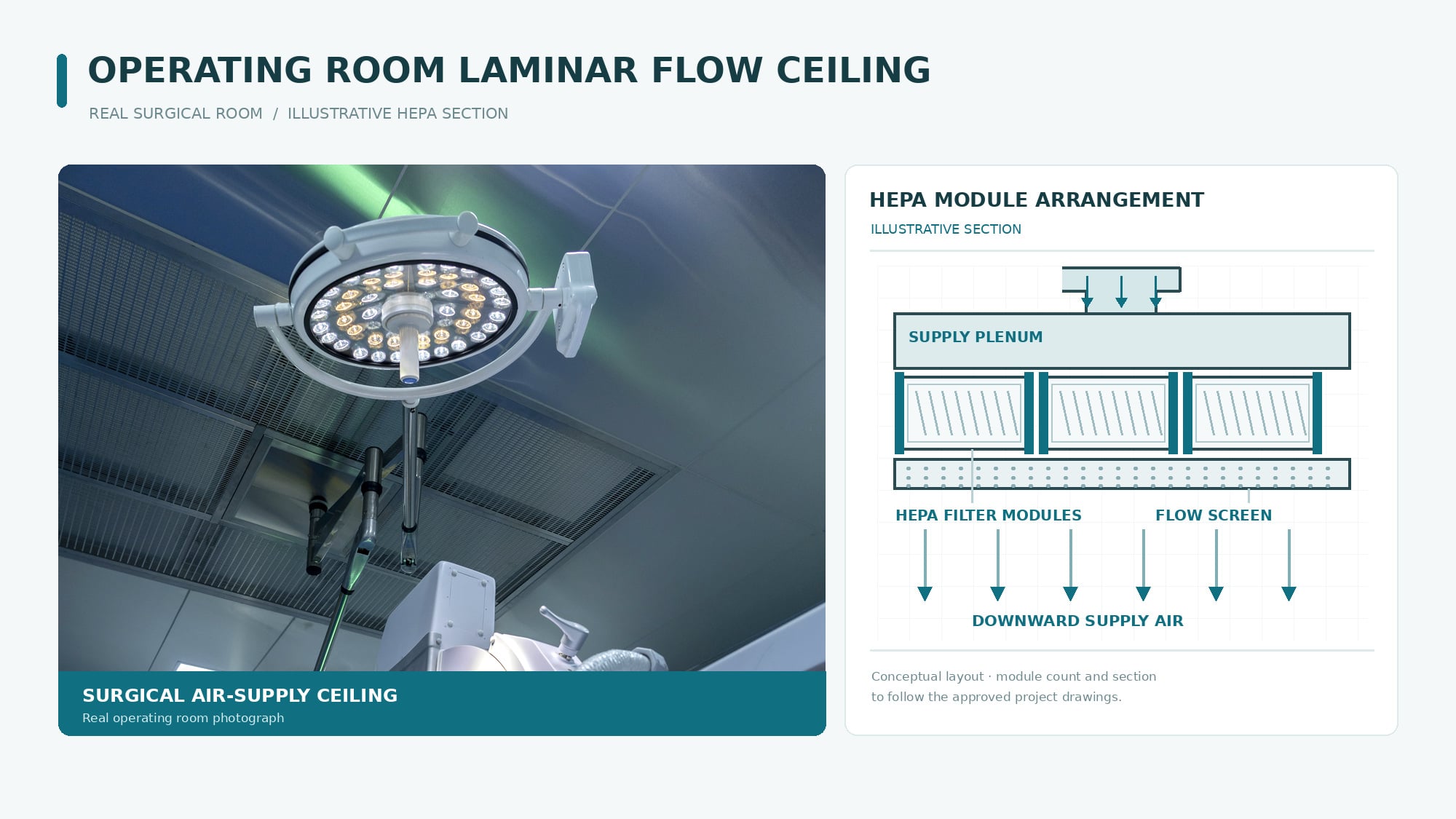 operating_room_laminar_flow_ceiling_real_photo.jpg