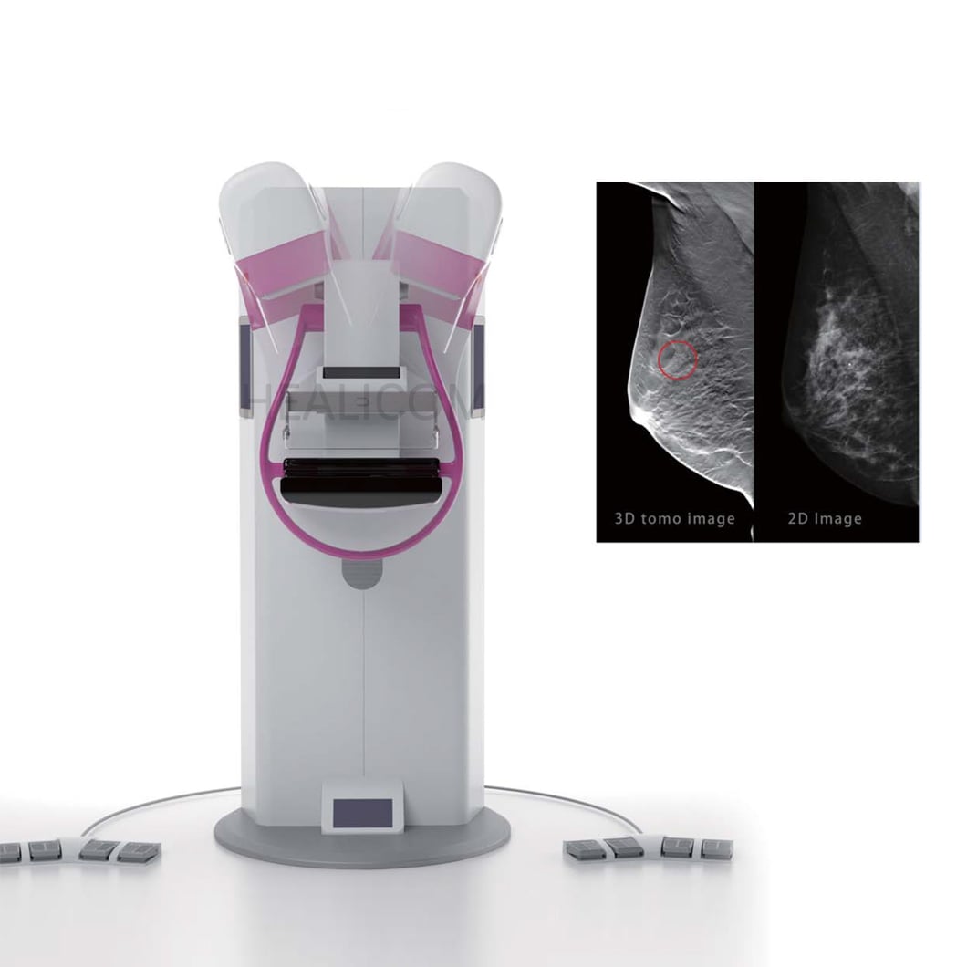 How Does an Xray Machine Generate Images for Diagnostic Use?
