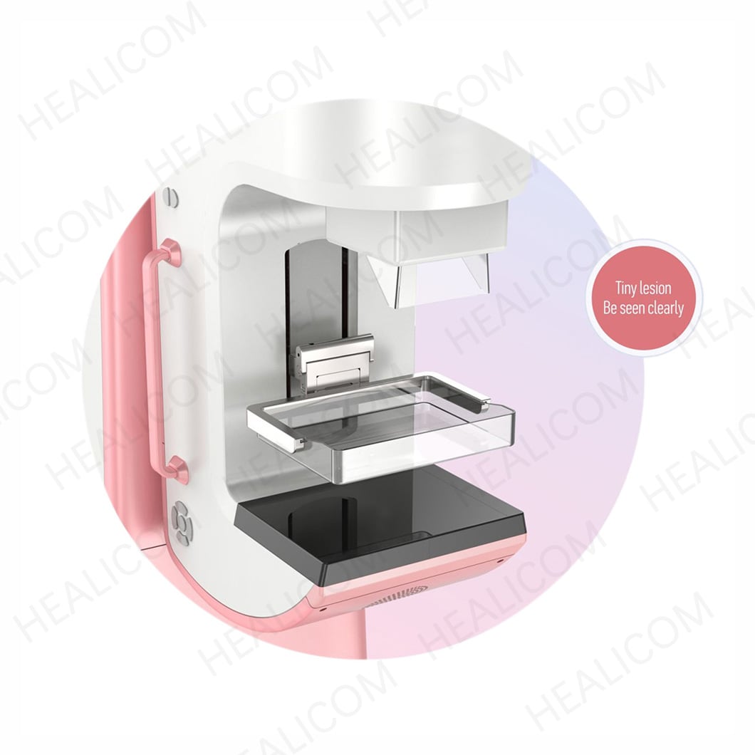 Digital mammography