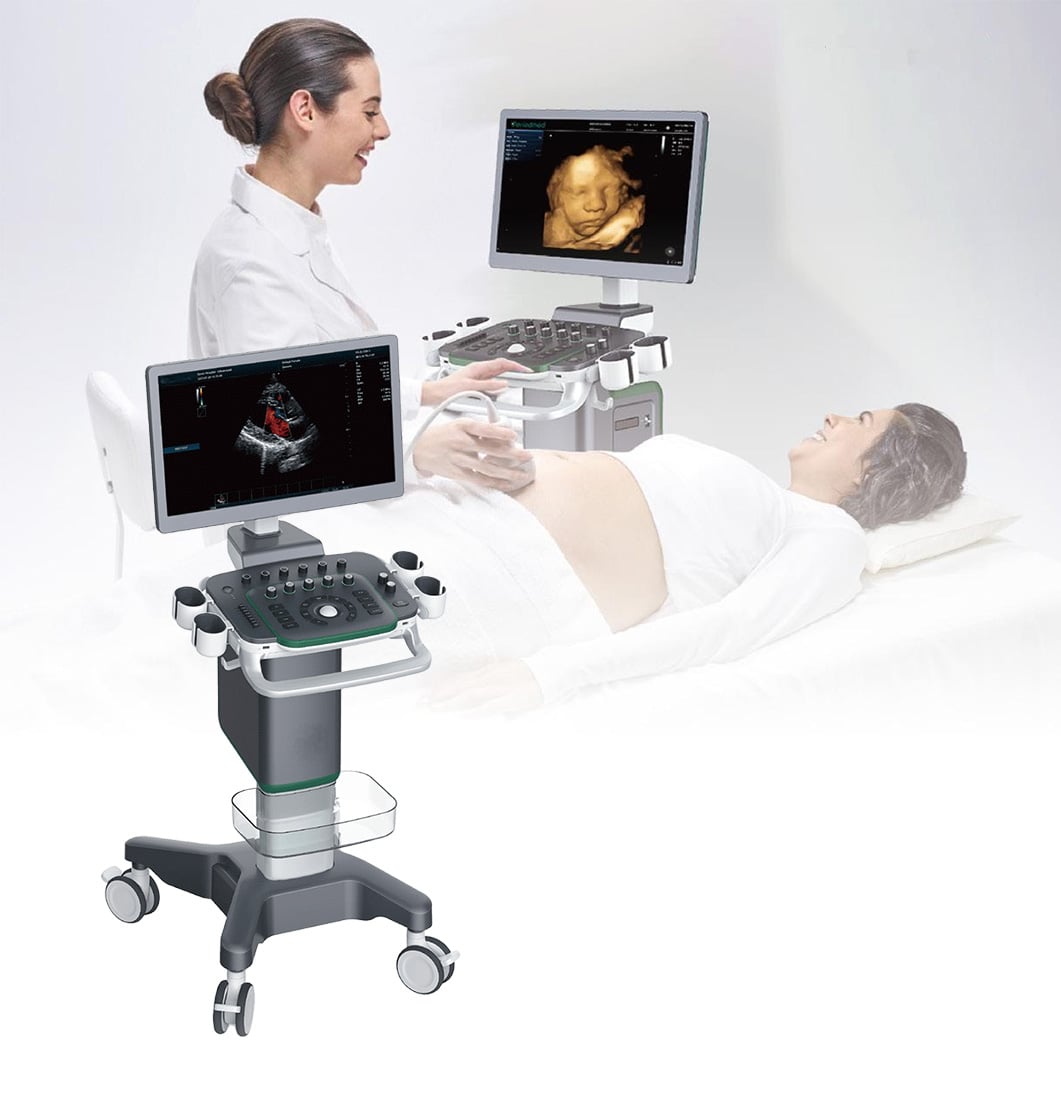 Medical User Friendly Digital Real-time Automatic Calculation Color Doppler Ultrasound