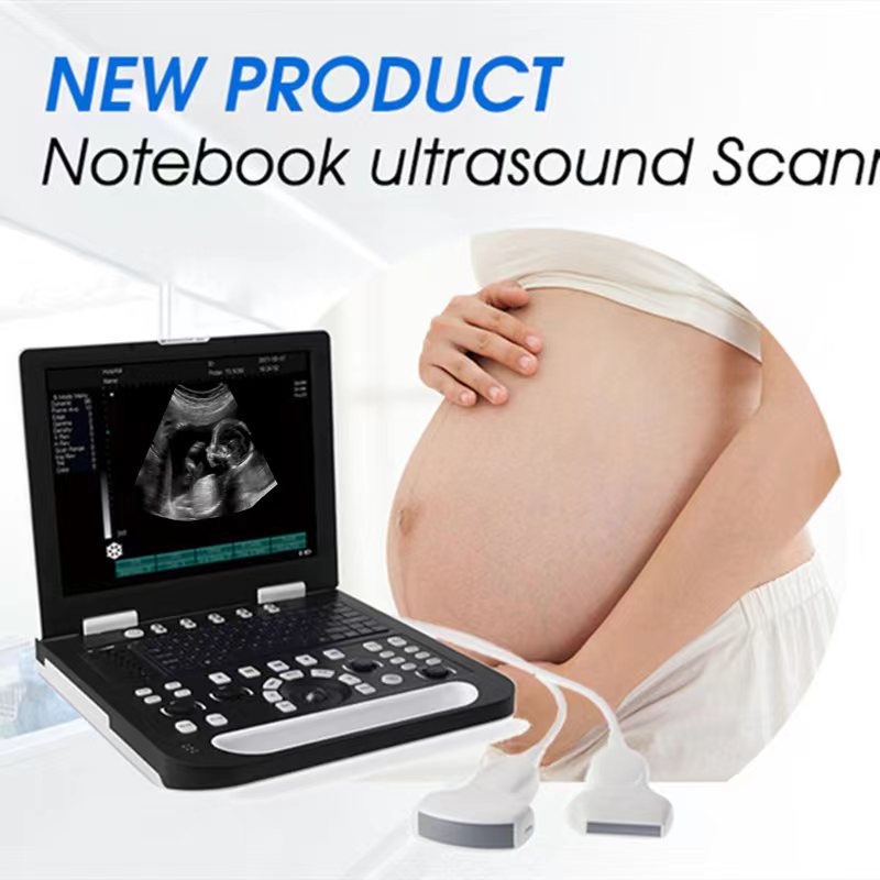 Matching Clinical Needs to Ultrasound Machine for Sale Features