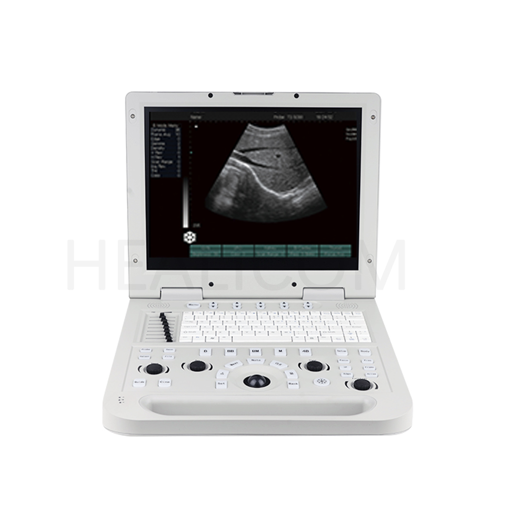 What Components Are Included in a Complete Set of Ultrasound Equipment?
