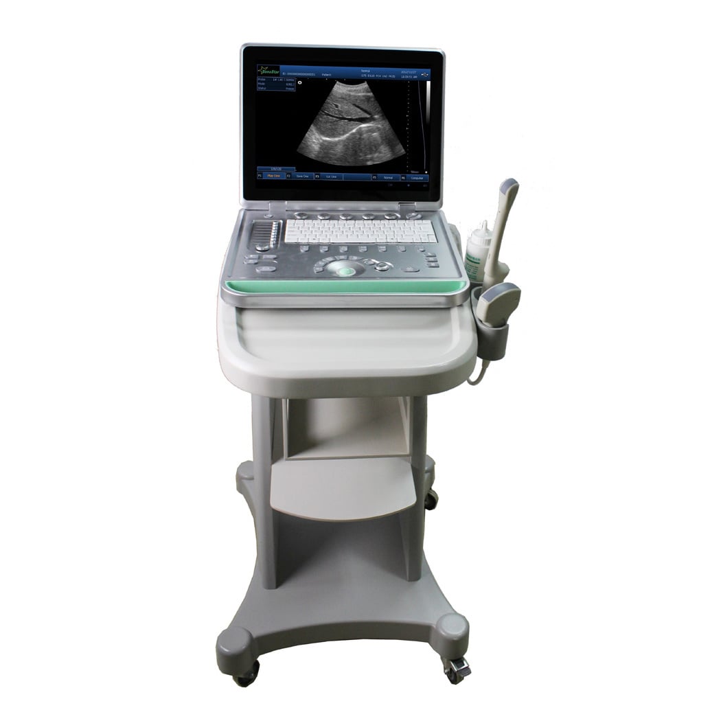 What Are the Key Functions to Look for in a Portable Ultrasound?
