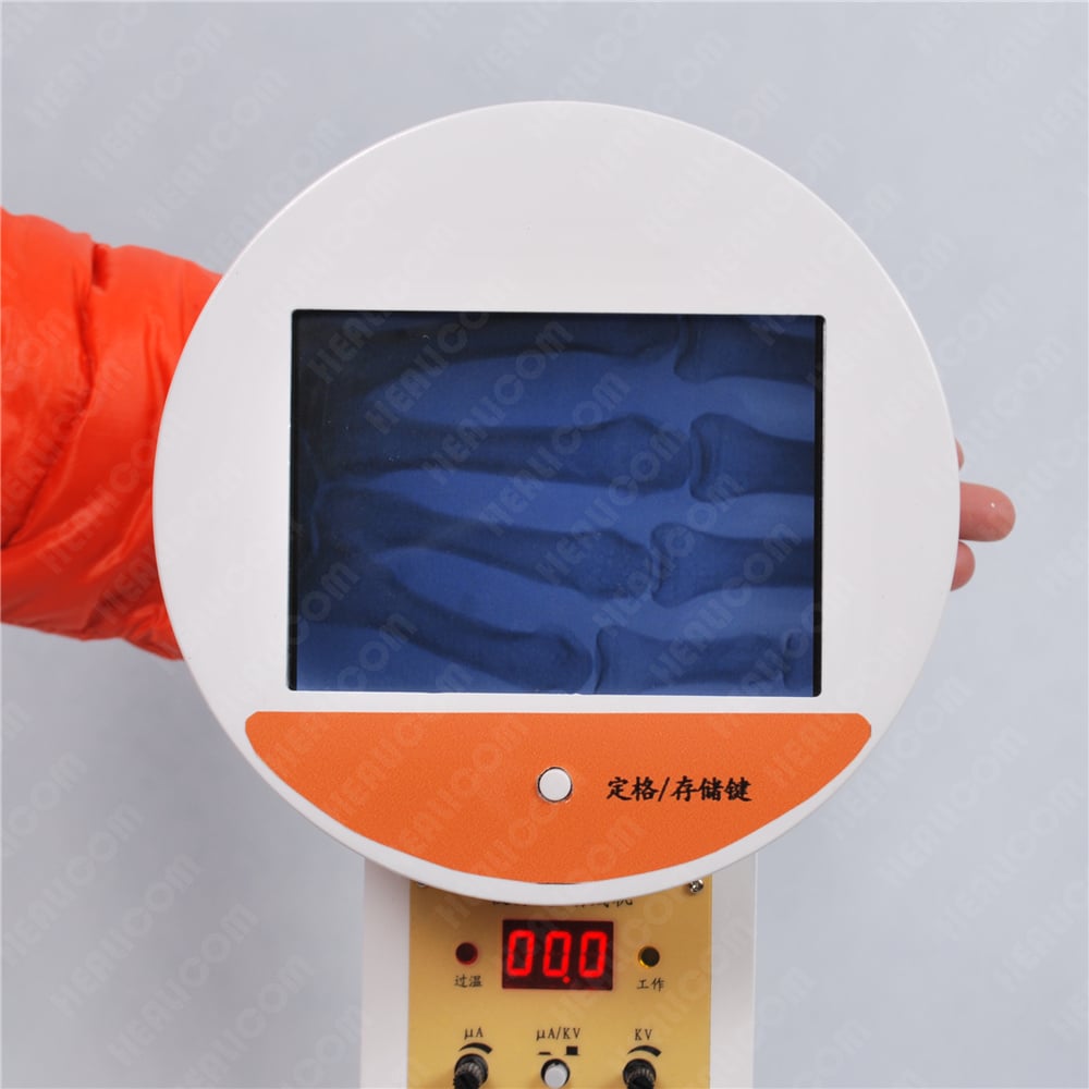 HFX-01 portable X ray USD2499PC,EXW