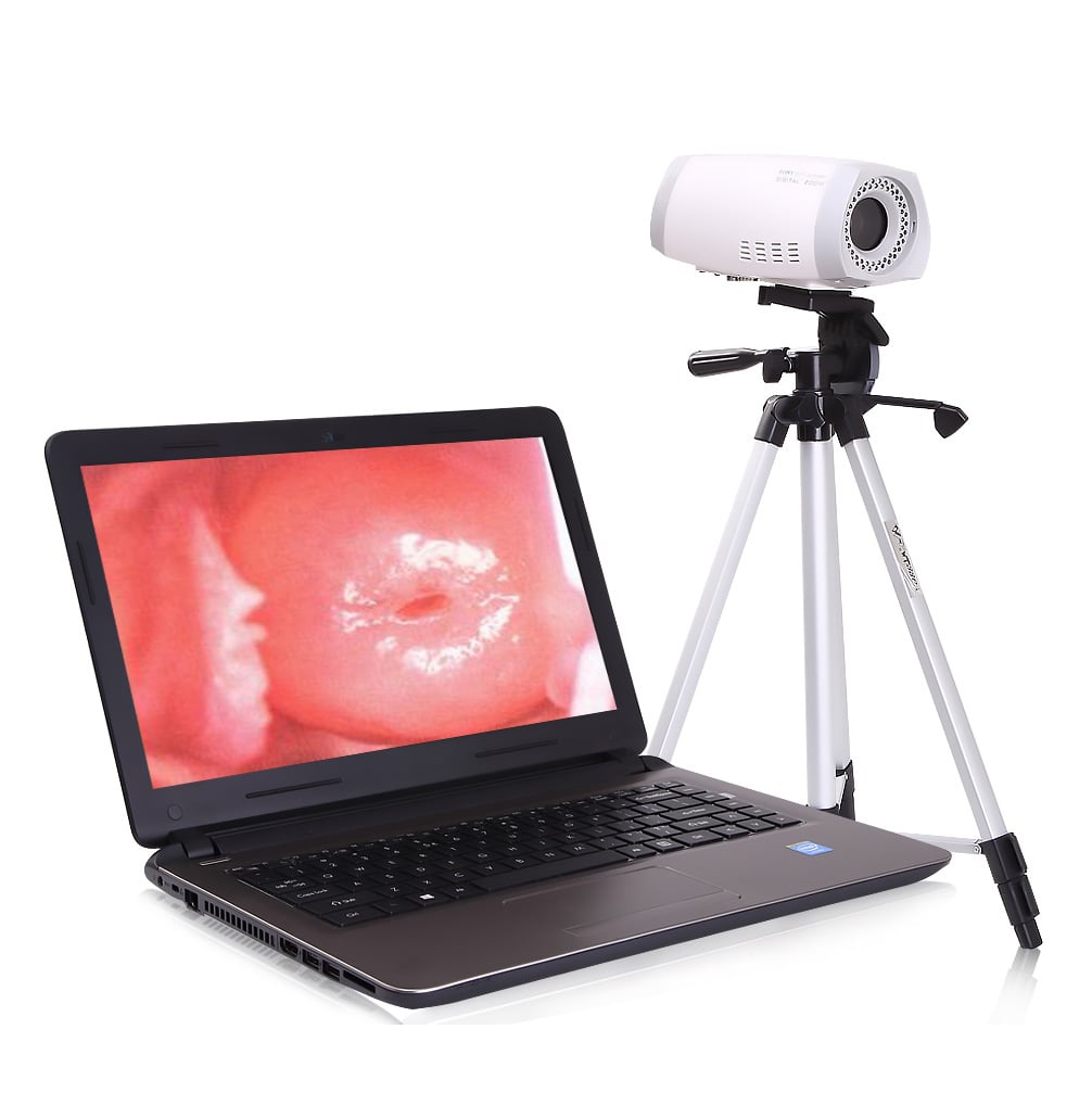 What Is a Colposcope? How Does It Help in Cervical Health Checks?
