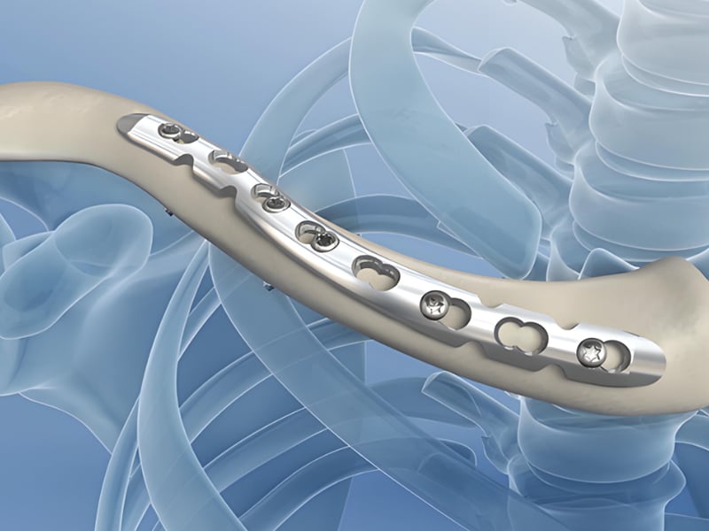 TA2/GR2 Titanium Plate & Rod: Versatile Pure Titanium for Corrosion Resistance and Lightweight Engineering