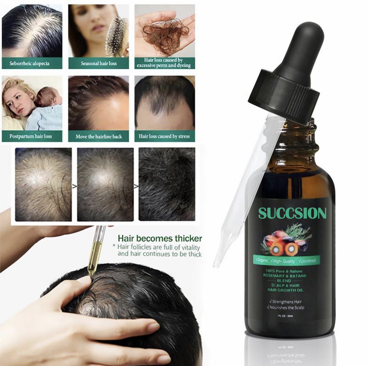 Revitalize Your Hairline and Regrow Your Hair with Castor Oil u2013 Naturally and Affordably!