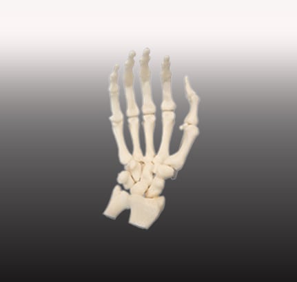Beenderen van de Hand