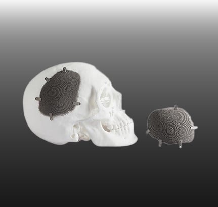 Medische Implantaten
