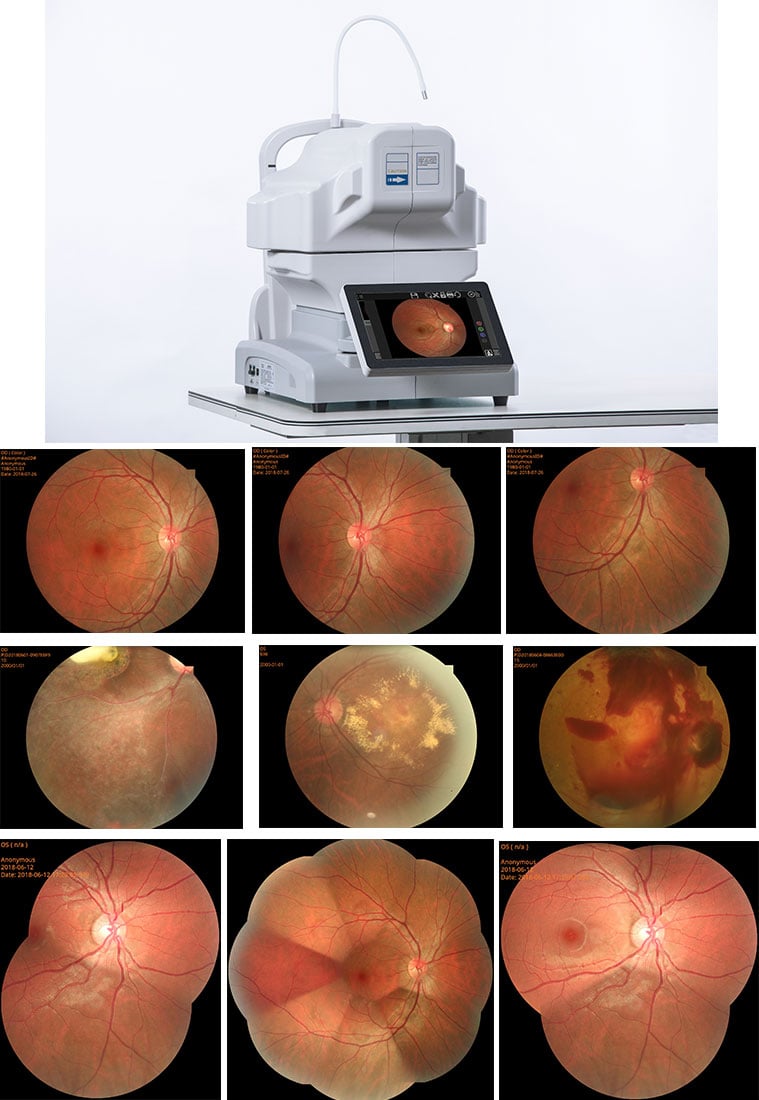 Pålidelig service til optometripraksis