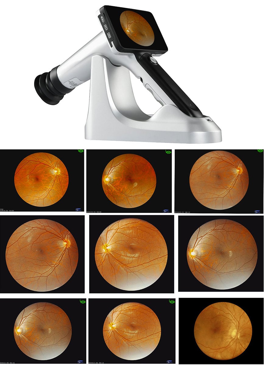 What Should Buyers Verify Before Connecting Ophthalmic Devices to an EMR or PACS?
