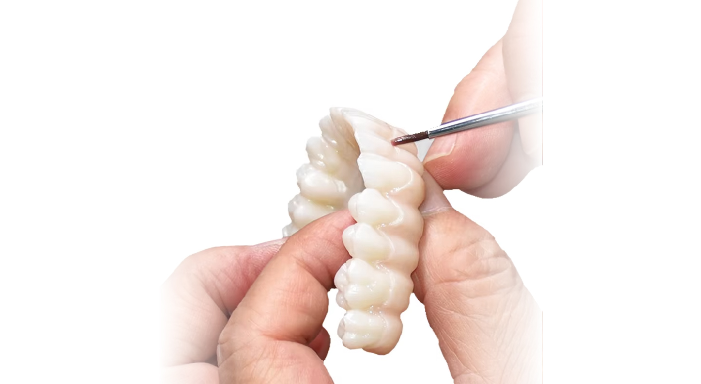 4d x ml the ideal restoration choice in the digital dentistry era-3