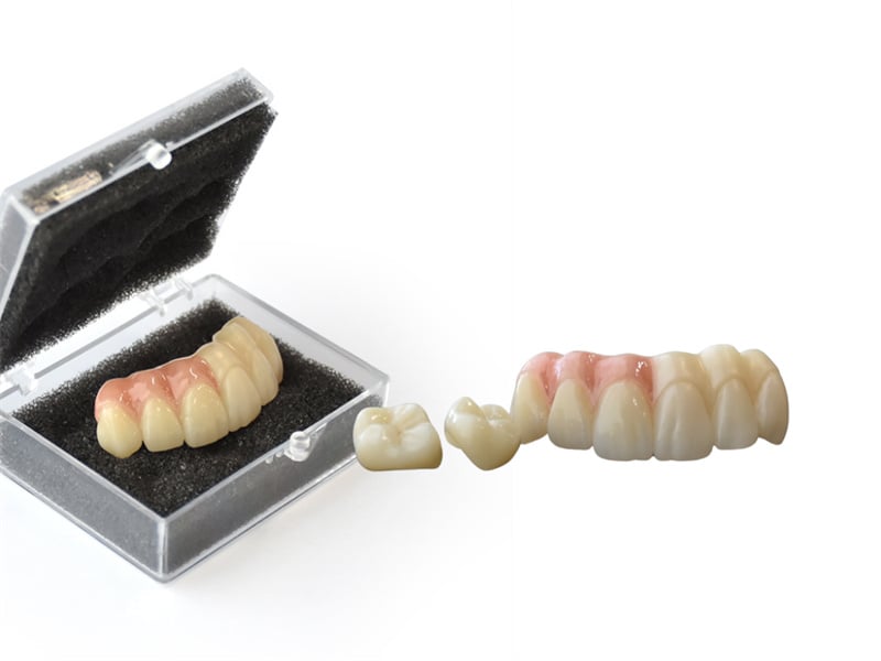 6 units bridge, made of 4D X ML zirconia block.jpg