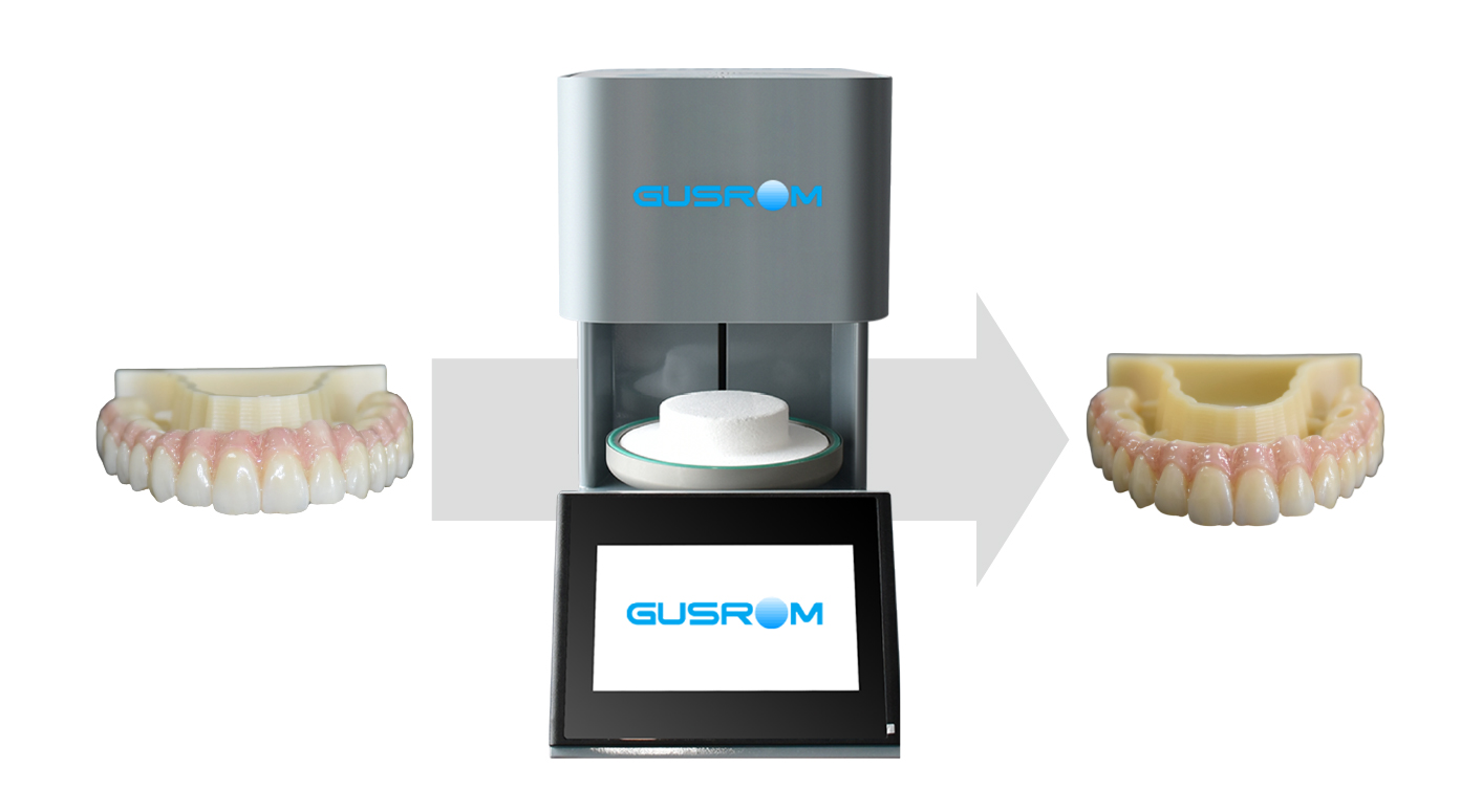 4d x ml the ideal restoration choice in the digital dentistry era-4