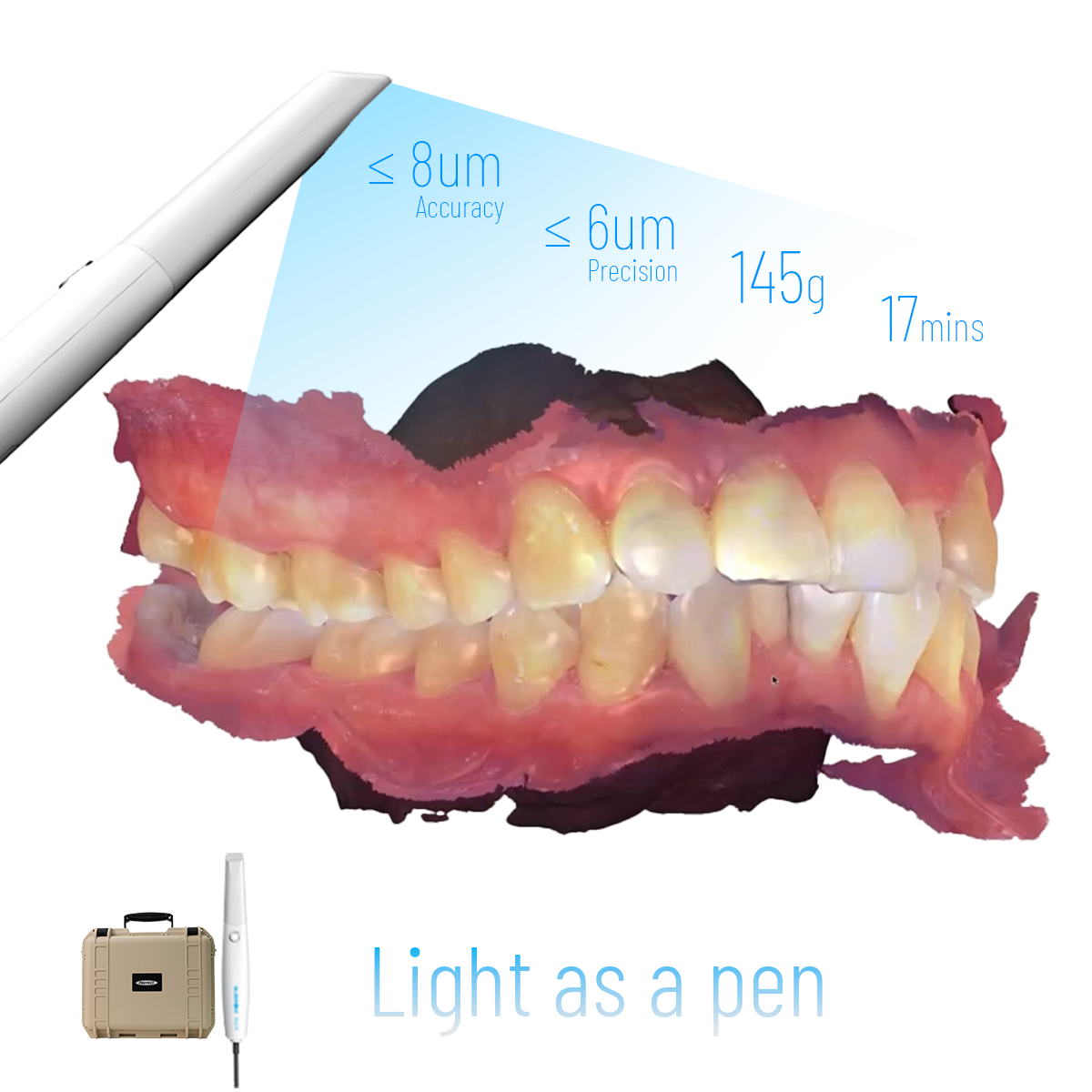 What Makes Dental Scanners Essential for Modern Dentistry?