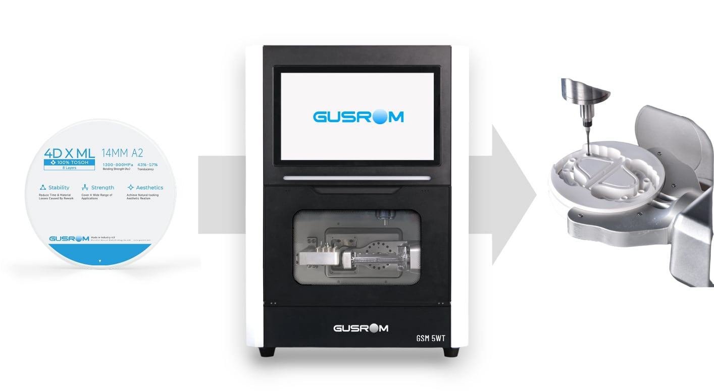 4d x ml the ideal restoration choice in the digital dentistry era-2