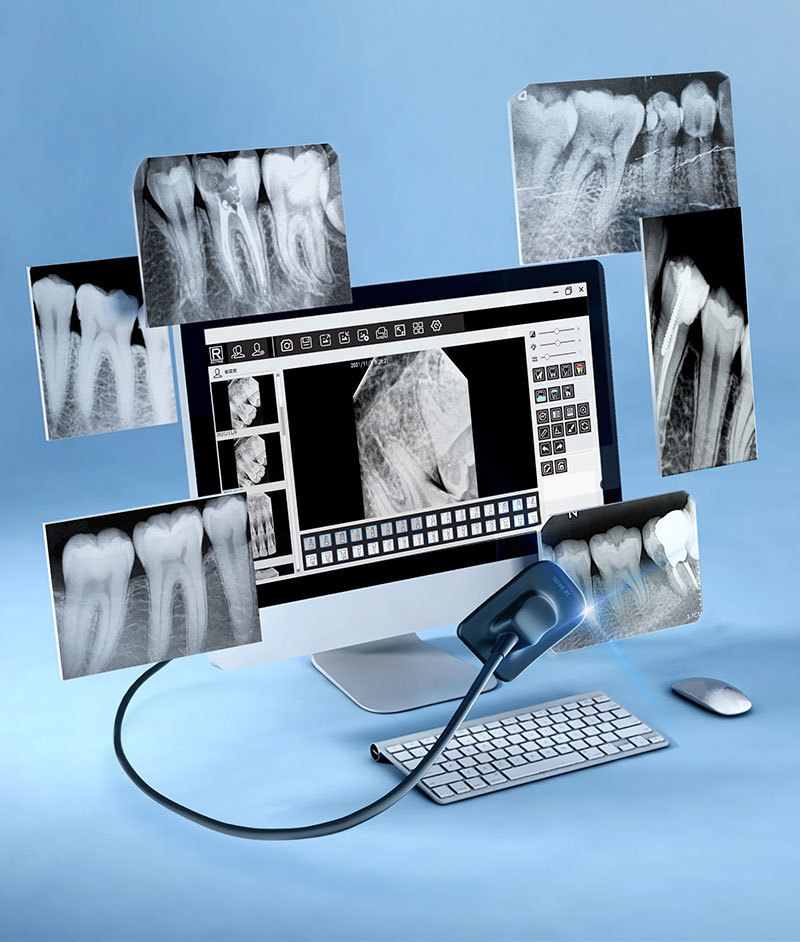 High-Precision Hybrid Cables vs. Fine Coaxial: Decoding the Backbone of Modern Dental Endoscopes