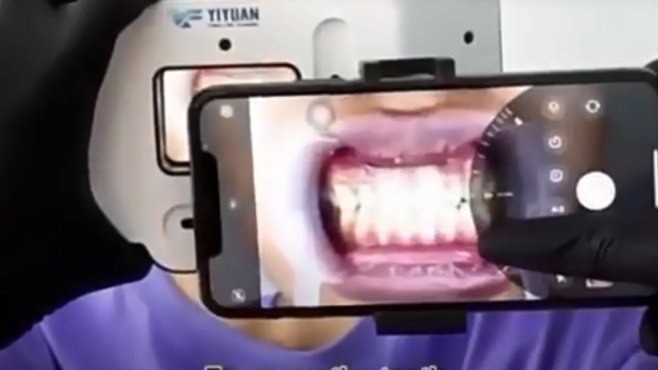 Foshan factory low price dental handheld supplementary light for oral photography