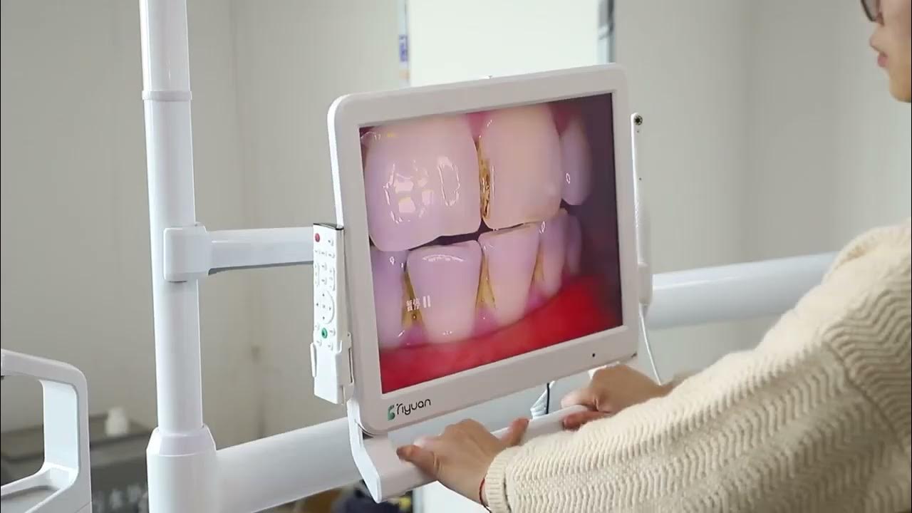 LED Screen HD Dental Intra Oral Camera with WiFi