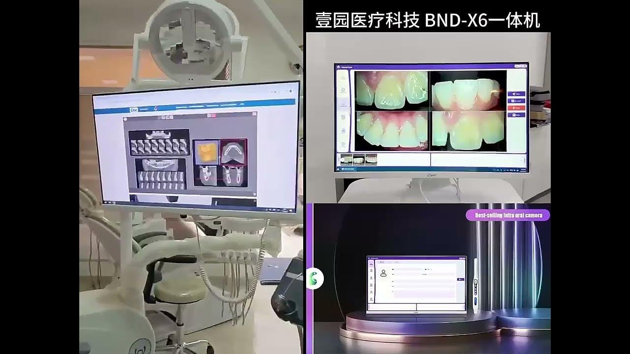 Hot selling touch screen endoscope computer oral camera built-in dedicated software
