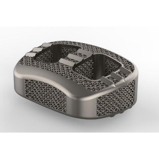 DMK Industrial Metal 3D Printing Services factory