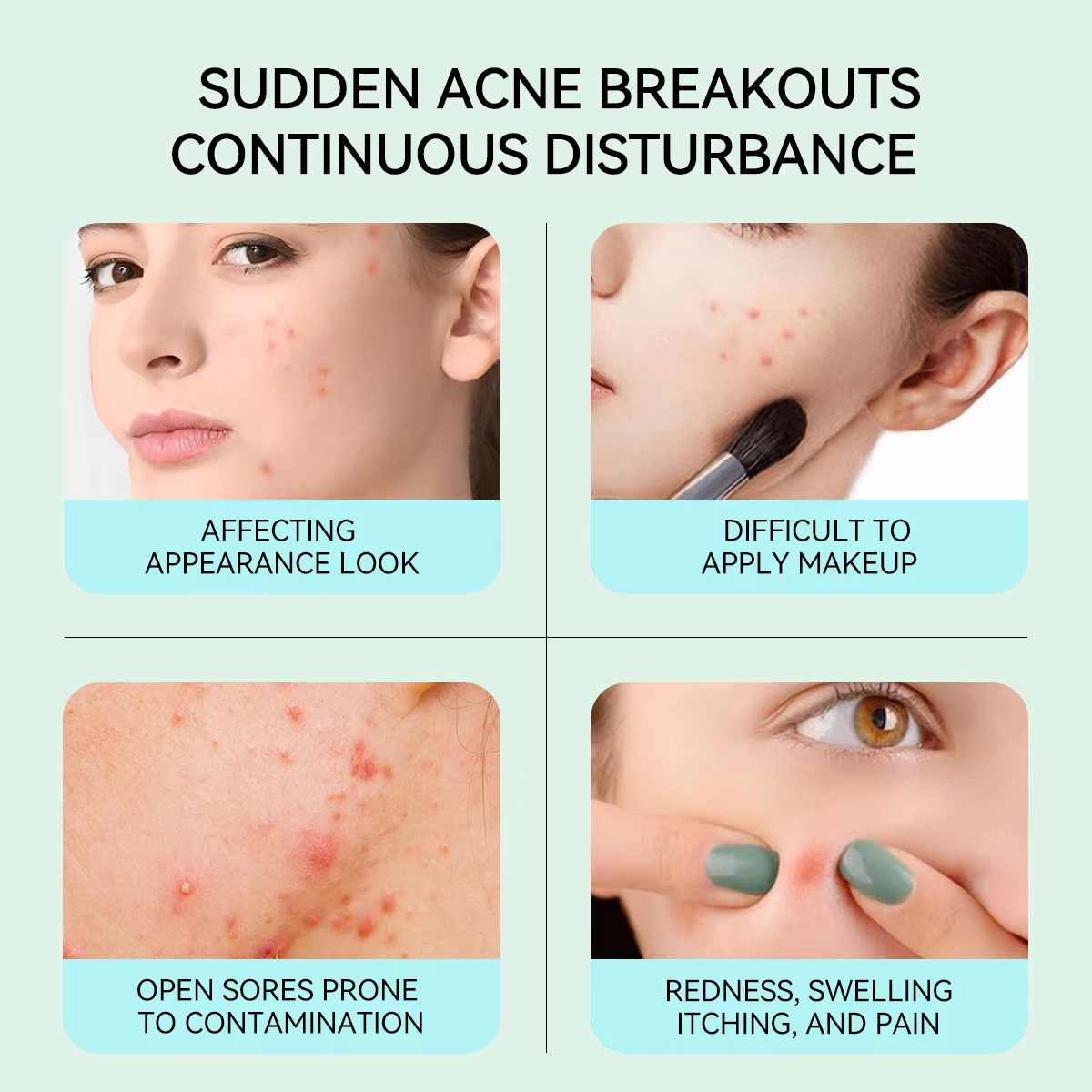 Can Pimple Patch Prevent Acne Scars Effectively?