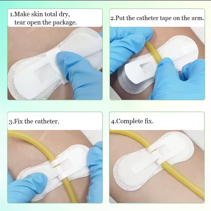 IV Securement 101: Best Practices for Nurses & Caregivers