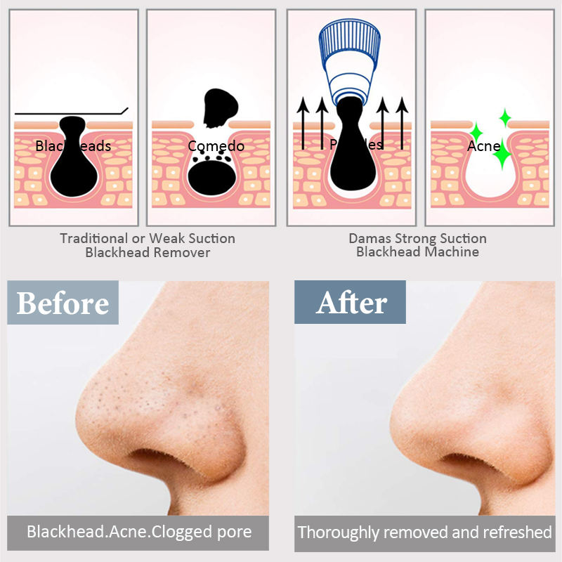 Innovative Technology for Effective Pain Management