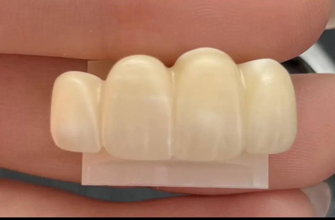 Why Do White Lines Appear After Zirconia Sintering? A Manufacturer’s Perspective