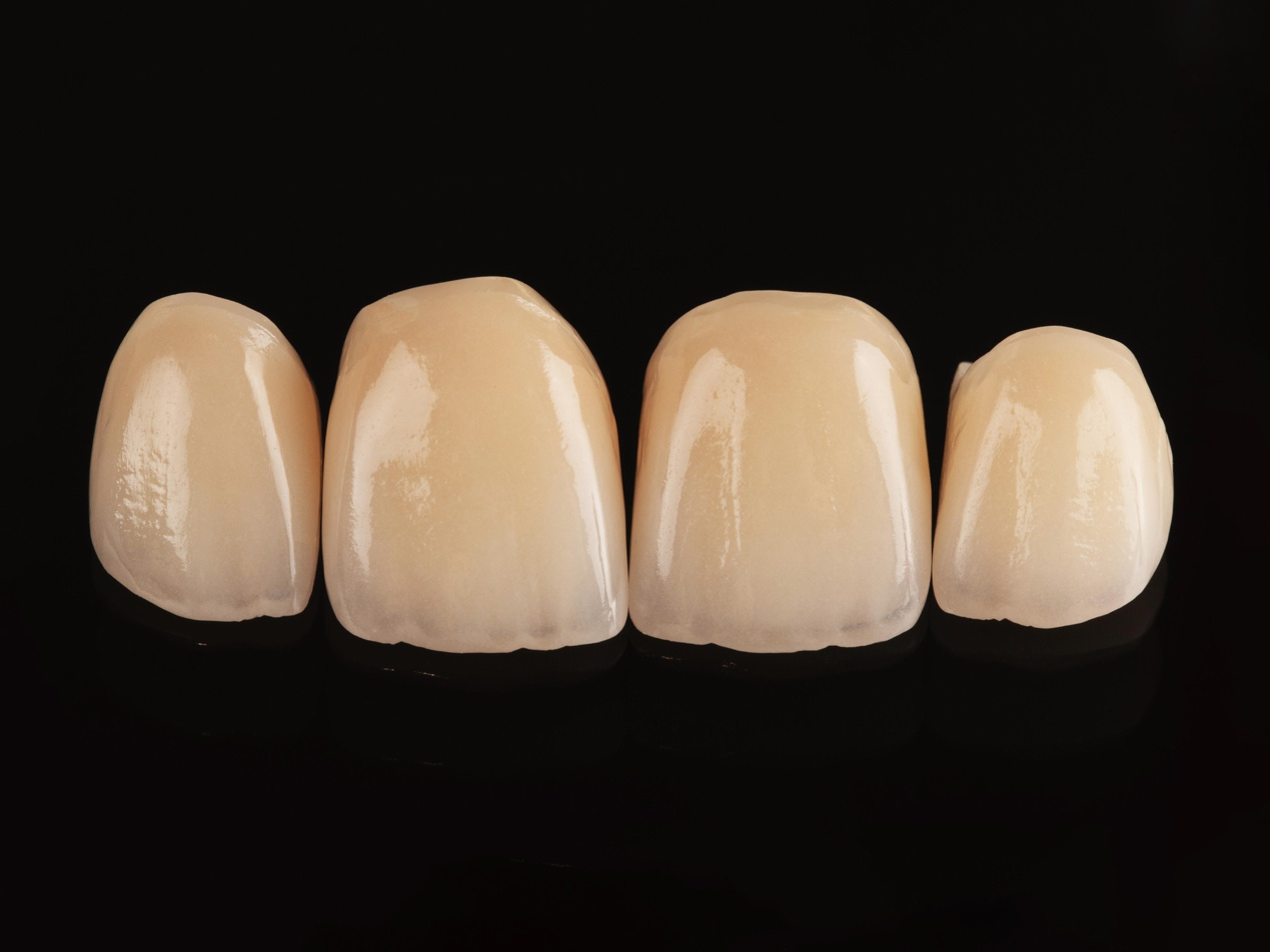 The Hidden Risks of Incorrect Sintering Temperatures