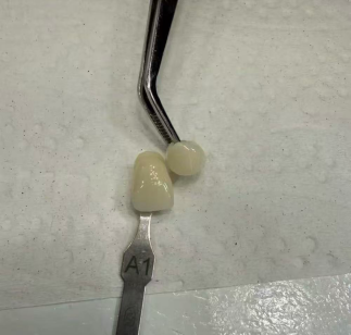 When Zirconia Comes Out Too White: A Manufacturer's Perspective