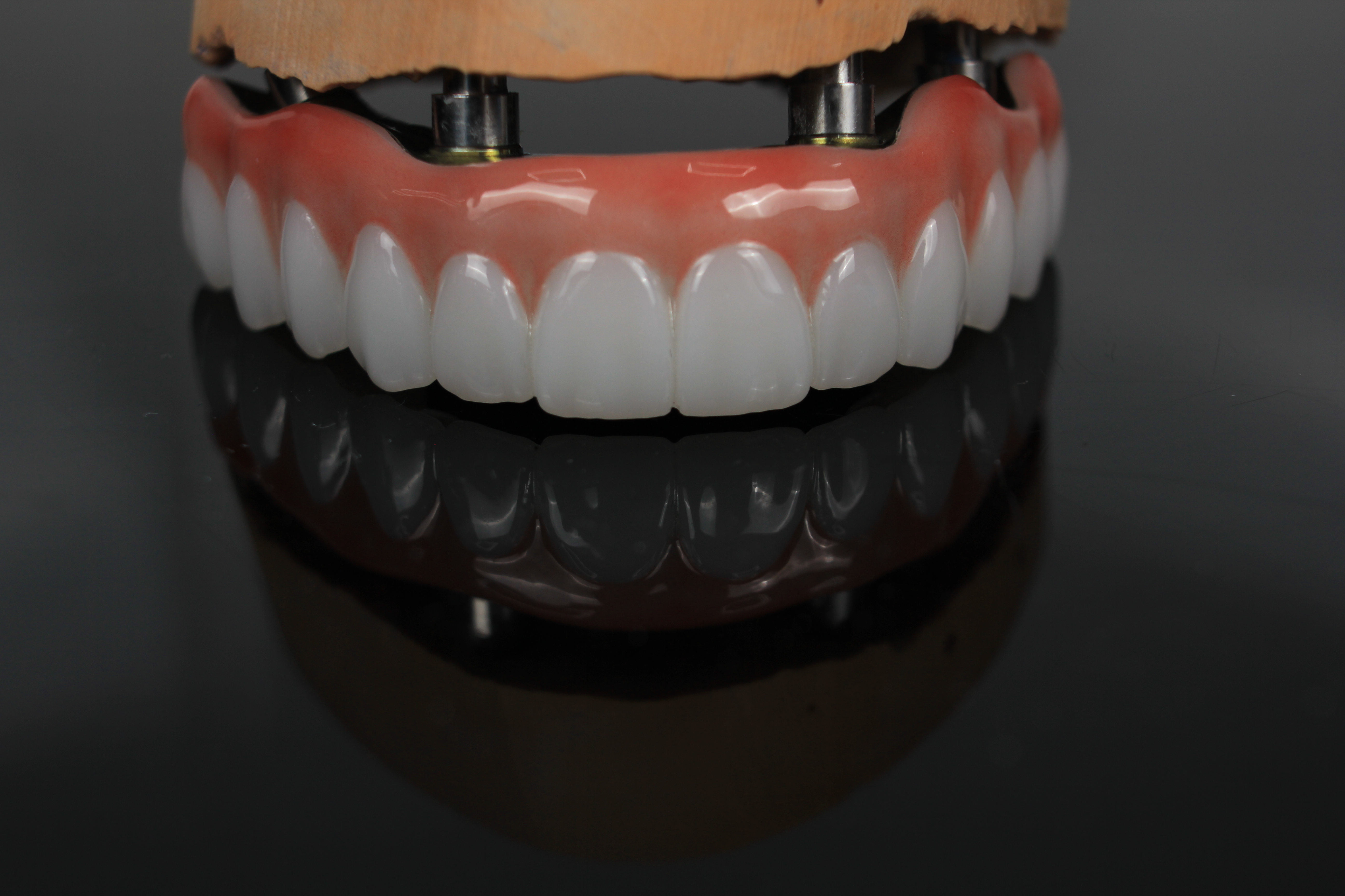 Nepovezana trpežnost in estetika odpornih proti obrabi cirkonijevih dentalnih mostov